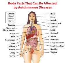 autoimmune diseases putting out the fire 5d2f8f1d0a9fe