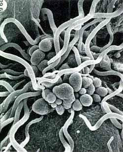lymes disease img 1 lymes disease img 1