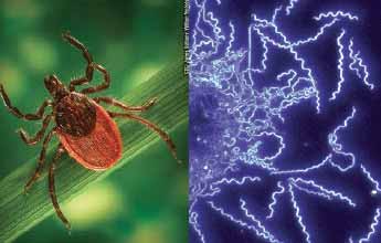 lymes disease img 2 lymes disease img 2