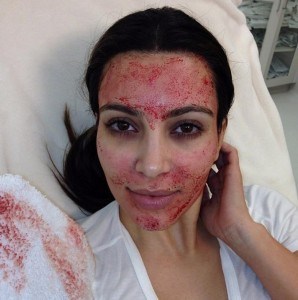 vampire facial kim kardashian