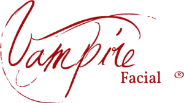 vampire facial 1 300x169 1